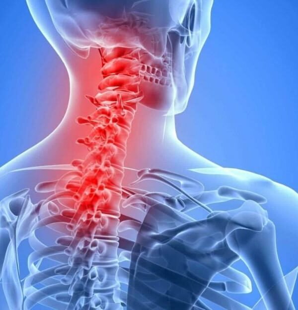 Neck Pain Physiotherapy at Home in Bangalore
