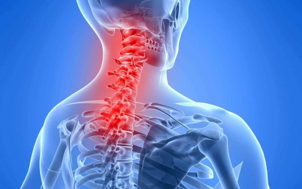 Neck Pain Physiotherapy at Home in Bangalore